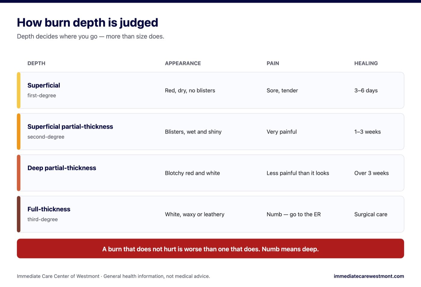 Chart of the four burn depths showing appearance, pain level and expected healing time